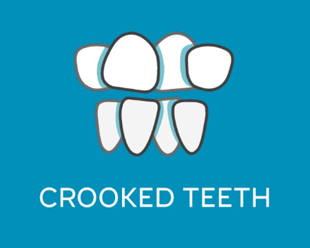 Lifetime-Crooked-Teeth